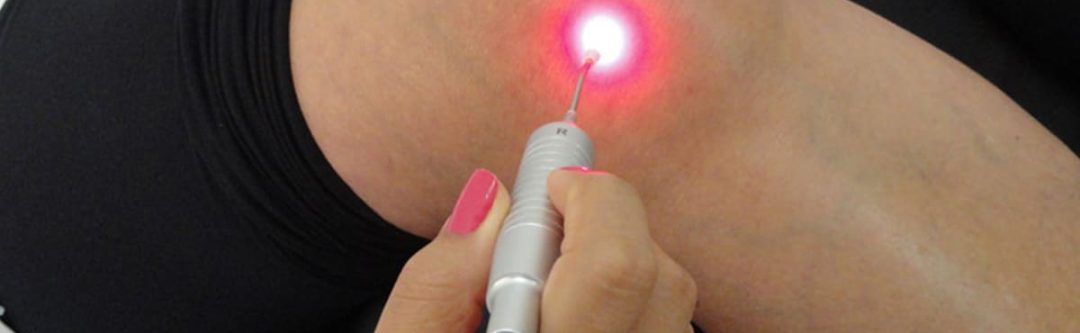 beneficios-da-laserterapia-no-tratamento-de-feridas